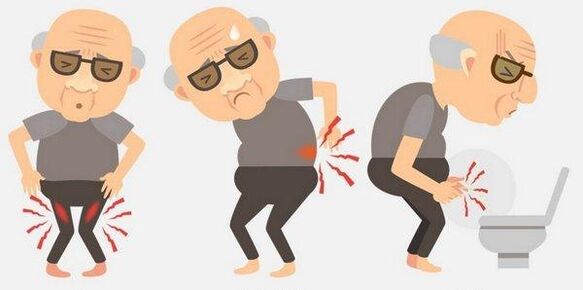 Symptome einer Prostatitis